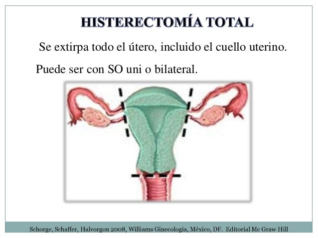 histerectomia total abdominal